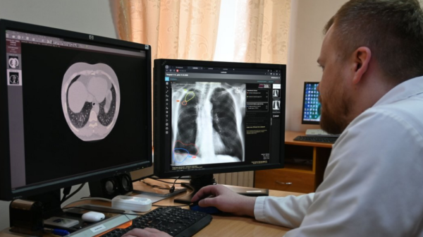 Искусственный интеллект на страже здоровья: брянские врачи получили цифрового ассистента